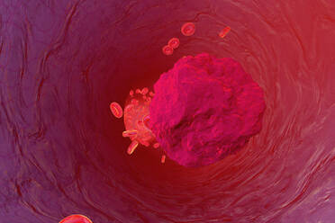 3D rendered Illustration, Mutated leukaemia cell in the lood stream - SPCF00482