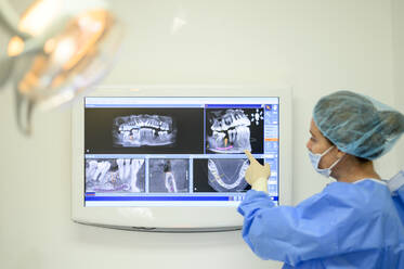 Dentist surgeon showing implant radiography - OCMF00869