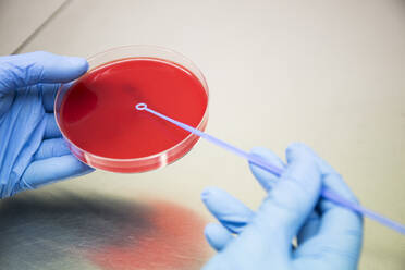 Hände mit Handschuhen bei der Arbeit in einem mikrobiologischen Labor auf einer Petrischale ablegen - ABZF02815