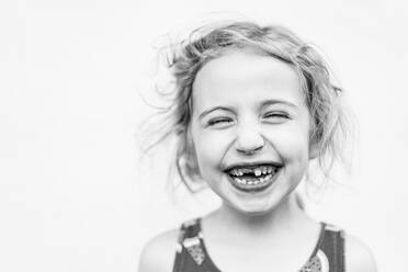 A portrait of a little girl missing her front tooth. - CAVF69876