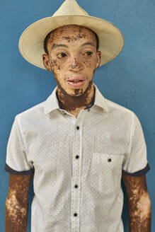 Porträt eines jungen Mannes mit Vitiligo, der einen Hut trägt, blaue Wand im Hintergrund - VEGF01332