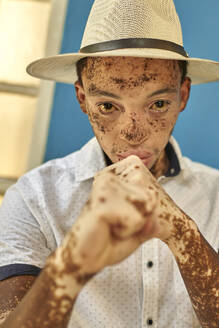 Portrait of young man with vitiligo wearing a hat, showing his fist - VEGF01335
