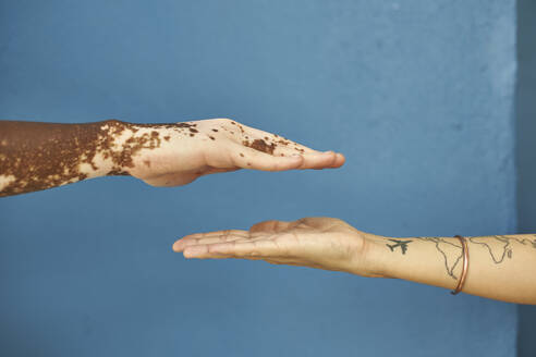 Hand of a man with Vitiligo and a white woman hand against blue wall - VEGF01336