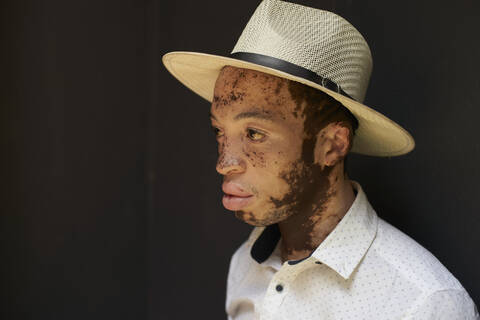 Porträt eines jungen Mannes mit Vitiligo, der einen Hut trägt, lizenzfreies Stockfoto