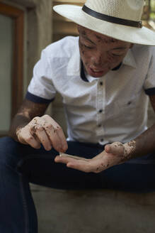 Junger Mann mit Vitiligo dreht eine Zigarette - VEGF01348
