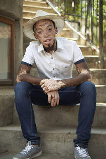 Portrait of young man with vitiligo wearing a hat and sitting on the stairs - VEGF01350