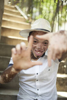 Porträt eines jungen Mannes mit Vitiligo, der einen Hut trägt und auf einer Treppe sitzt und sein Gesicht mit den Händen umrahmt - VEGF01353
