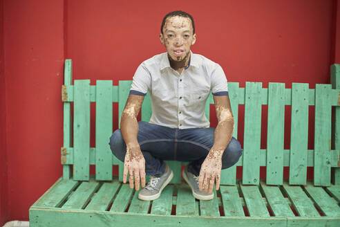 Young man with vitiligo on a green bench in front of a red wall - VEGF01357