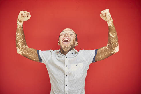 Junger Mann mit Vitiligo schreit vor Freude und lacht auf einer roten Wand - VEGF01360