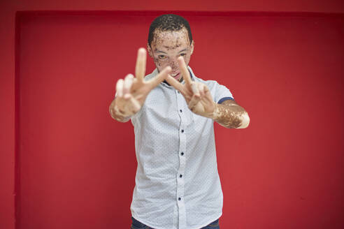 Young man with vitiligo doing the victory sign in front of a red wall - VEGF01362