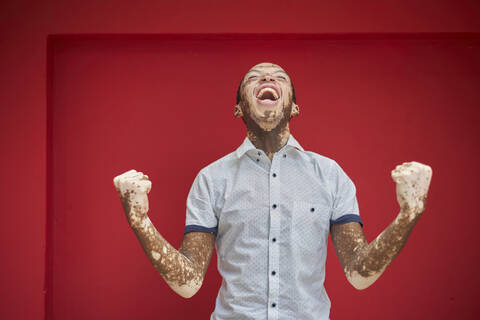 Junger Mann mit Vitiligo schreit vor Freude und lacht auf einer roten Wand, lizenzfreies Stockfoto