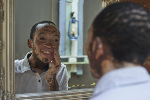 Junger Mann mit Vitiligo beim Blick in den Spiegel - VEGF01366