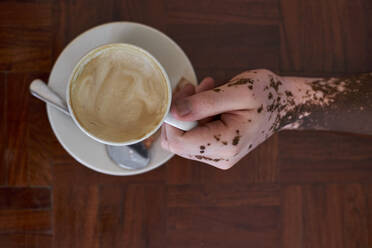 Nahaufnahme von oben der Hand eines Mannes mit Vitiligo, der einen Kaffeebecher hält - VEGF01372