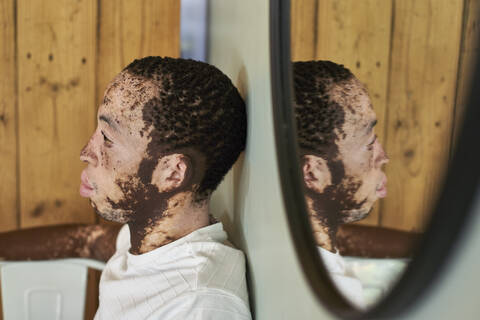 Junger Mann mit Vitiligo und seine Reflexion im Spiegel, lizenzfreies Stockfoto