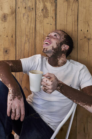 Young man with vitiligo having a cup of coffee and laughing in a cafeteria stock photo
