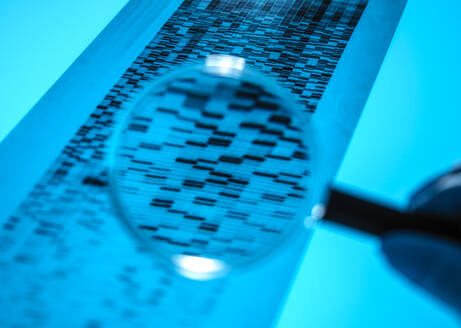 Hand eines Wissenschaftlers, der ein Vergrößerungsglas benutzt, um die Ergebnisse der DNA-Sequenzierung zu analysieren - ABRF00663