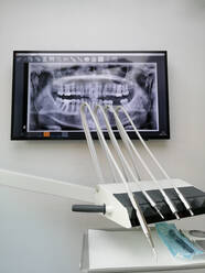 Zahnärztliches Röntgenbild auf einem Monitor in einer Zahnarztpraxis - CHPF00598