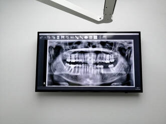 Deutschland, Zahnärztliches Röntgen in der Zahnarztpraxis - CHPF00635