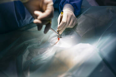 Close-up of veterinarian in a surgery - ABZF02978