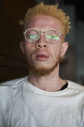 Portrait of an albino man with round glasses - VEGF01666