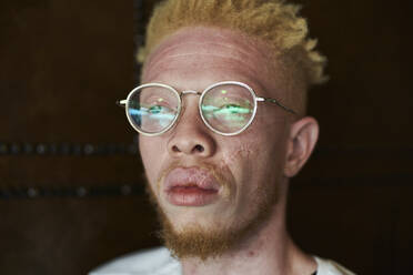 Portrait of an albino man with round glasses - VEGF01667