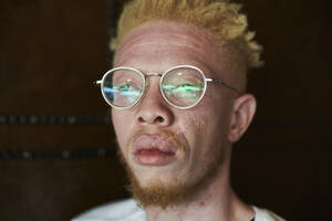 Porträt eines Albino-Mannes mit runder Brille - VEGF01667