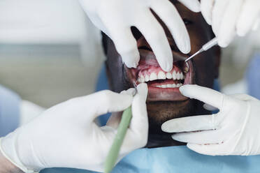 Close-up of patient getting dental treatment - JCMF00414