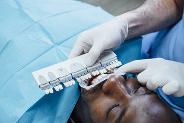 Close-up of patient getting dental teeth whitening treatment - JCMF00422