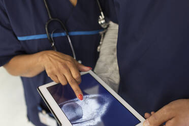 Nahaufnahme von Ärzten, die ein digitales Röntgenbild auf einem digitalen Tablet im Krankenhaus untersuchen - CAIF24843
