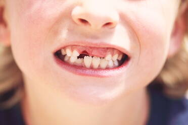 Close-Up Of Gap Toothed Boy - EYF01819