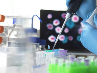 Pharmaceutical research into infectious disease and pandemics, scientist pipetting a sample of a new drug formula into a vial during a clinical trial with the infectious disease on the computer screen - ABRF00721