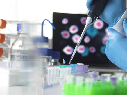 Pharmaceutical research into infectious disease and pandemics, scientist pipetting a sample of a new drug formula into a vial during a clinical trial with the infectious disease on the computer screen - ABRF00721