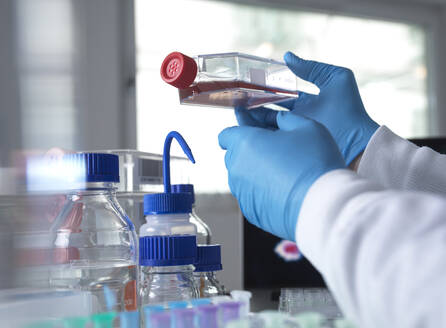 Pharmaceutical research into infectious disease and pandemics, Scientist viewing cells in a jar during a clinical trial - ABRF00724