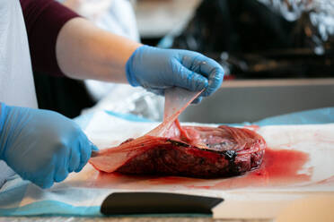 Person with close pulling apart amniotic sac from placenta. - CAVF80223