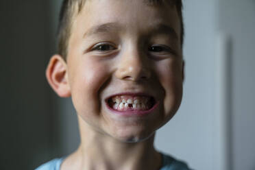 Portrait of little boy showing his tooth gap - MGIF00907