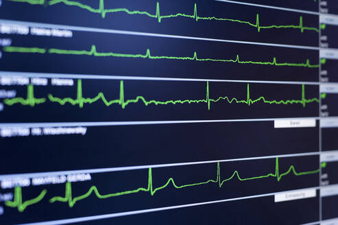 Close-up of EKG screen display - SKAF00137