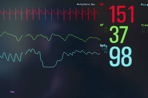 Close-up of EKG screen display - SKAF00138