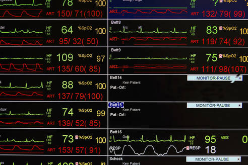 Close-up of EKG screen display - SKAF00139