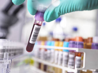 Hand of scientist wearing protective glove picking up sample in laboratory - ABRF00740