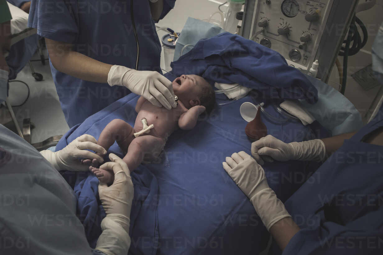 First moment of a newborn, labor in a hospital. After birth. stock photo