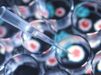 Close-up of pipette placing experimental vaccine into microplate - ABRF00765