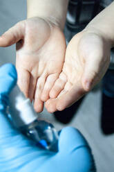 Arzt behandelt Kinderhände mit einem Antiseptikum - CAVF83432