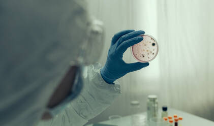 Cropped Image Of Surgeon Holding Medical Sample - EYF05268
