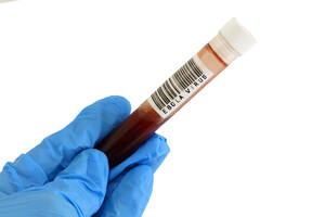 Cropped Hand Of Scientist Holding Test Tube With Ebola Virus Over White Background - EYF06619