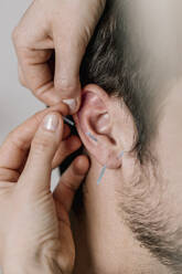 Traditional Chinese Medicine, TCM, acupuncture, ear with acupuncture needle during treatment - DAWF01667