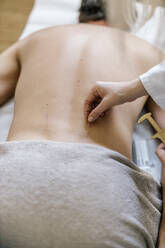Akupunktur, Rücken mit Akupunkturnadel während der Behandlung - DAWF01670