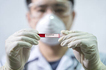 Asiatische Ärzte halten Blutprobe des Coronavirus 2019-Ncov, das in China Wuhan eine mysteriöse Viruserkrankung verursacht - EYF07834