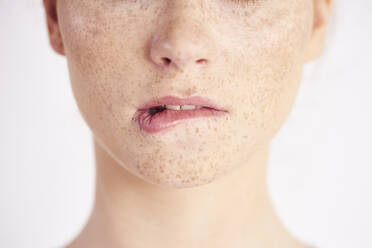 Midsection der Frau mit Sommersprossen im Gesicht vor weißem Hintergrund - EYF08343