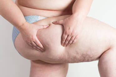 Midsection Of Obese Woman Holding Her Thigh Against White Background - EYF09044