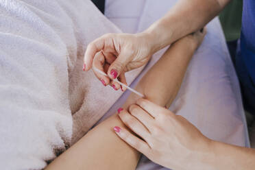 Close-up of woman inserting acupuncture needles in customer's arm on table - EBBF00528